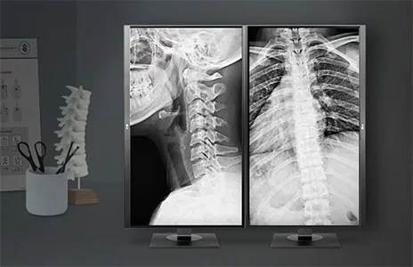 Specialised displays